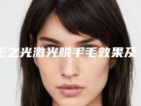 王之光激光脱手毛效果及优势有哪些