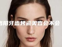 洛阳牙齿烤瓷美容会不会产生后遗症