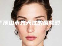 平顶山市先天性的唇腭裂治疗医生排行十强抢鲜看-焦桂兰医生厉害吗