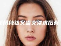 郑州纯钛义齿支架术后有哪些效果呢