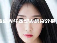 青岛光纤热塑去眼袋效果怎么样（青岛哪里做眼袋做的好）