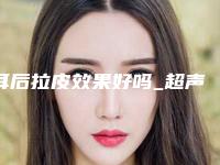 耳后拉皮效果好吗_超声波拉皮备孕有影响吗