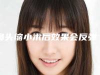 鼻头缩小术后效果会反弹吗缩小鼻头哪家好!